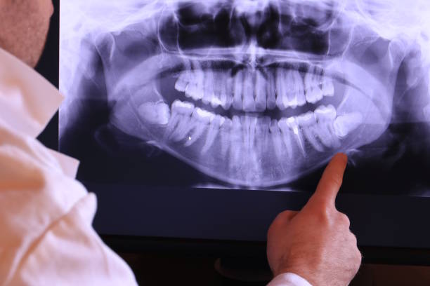 Best Emergency Dental Services for Seniors in Fort Hood, TX