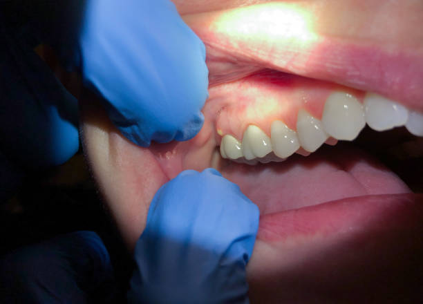 Best Mobile Emergency Dentist in Fort Hood, TX