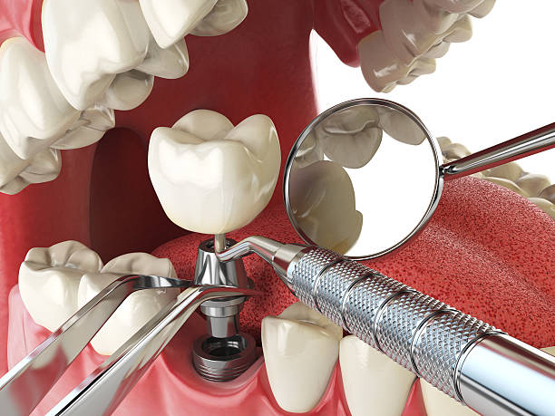 Best Broken or Cracked Tooth Emergency Dentist in Fort Hood, TX